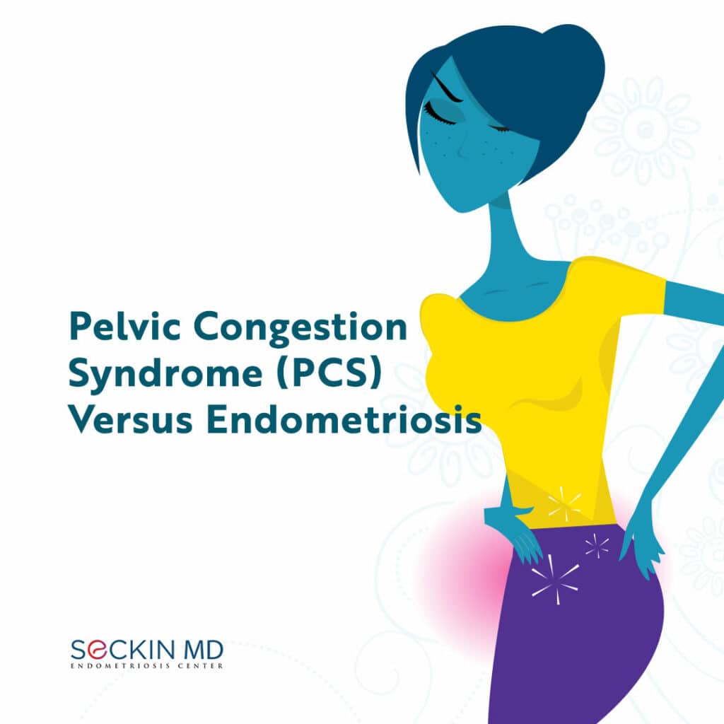Have you received a diagnosis of #endometriosis or PCS? Please do not hesitate to share your story by leaving a comment on our post. Read More: drseckin.com/pelvic-congest…