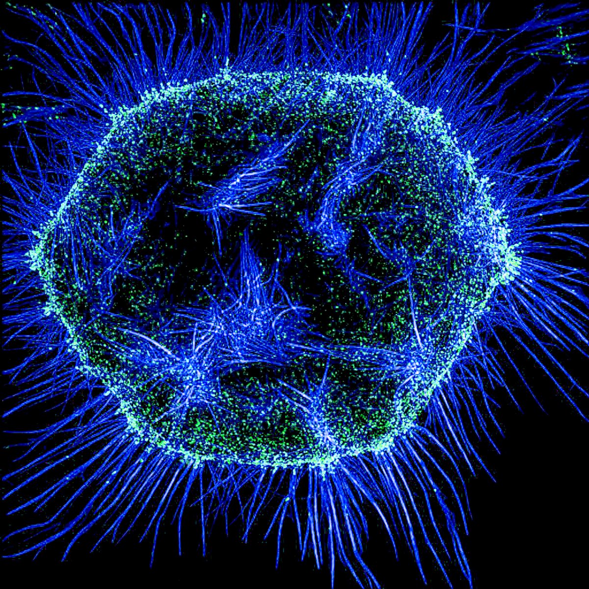A cell in metaphase photographed through a microscope. Two components of the cytoskeleton, actin filaments and myosin II, are shown. #CellBiology