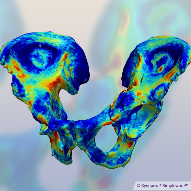 Simpleware_SNPS's tweet image. Visualization of pelvis in @Simpleware_SNPS used for 3D printing anatomical models. These models provide an excellent resource for virtual planning, education, and general understanding of anatomical function for users and patients: bit.ly/2ThbCDZ #medical3dprinting