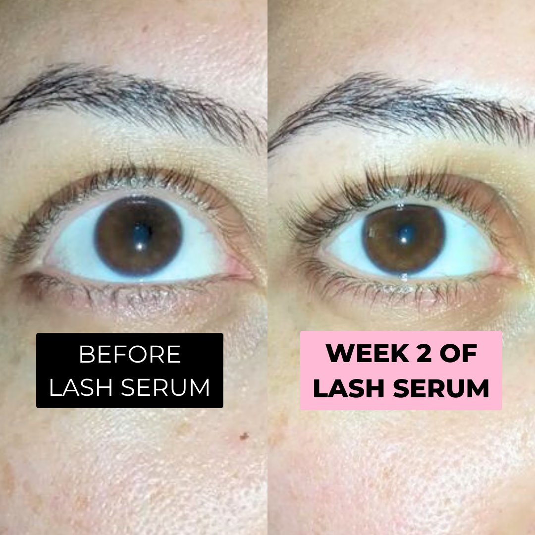 If you have brittle lashes, this is your sign to start using lash serum!! 💗 
@biuushine