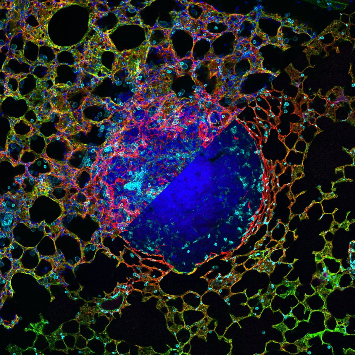 Oxford Instruments Andor (@andortechnology) on Twitter photo This beautiful <a href="/ImarisSoftware/">Imaris 3D/4D Imaging</a> snapshot from <a href="/dedonatis_m/">Marco De Donatis</a>, @CRUK_BI, is one of our favourite submissions for the 2023 Insight Awards so far. This beautiful <a href="/ImarisSoftware/">Imaris 3D/4D Imaging</a> snapshot from <a href="/dedonatis_m/">Marco De Donatis</a>, @CRUK_BI, is one of our favourite submissions for the 2023 Insight Awards so far.