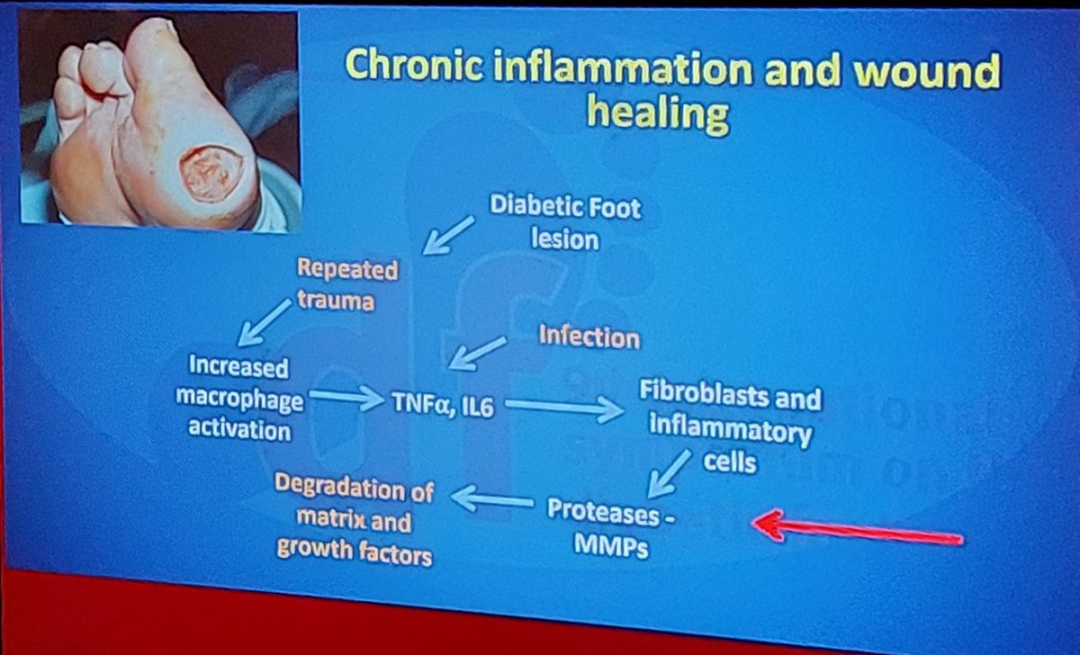 blindovanian's tweet image. #isdf2023 @IntSympDF in Hague was enormous experience for me and for sure will repeat it in 4 years. Big thanks to organizers and inspirational speakers for spreading hot topics about #diabetic_foot
