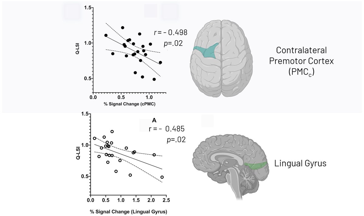 @criss_cody @NMBHAL_Lab Just published: Investigating brain activity & quadriceps weakness after ACL reconstruction - finding links between knee motor brain activity in premotor cortex and lingual gyrus & strength deficits. #ACLrecovery #Neuroplasticity'
rdcu.be/dcl3J