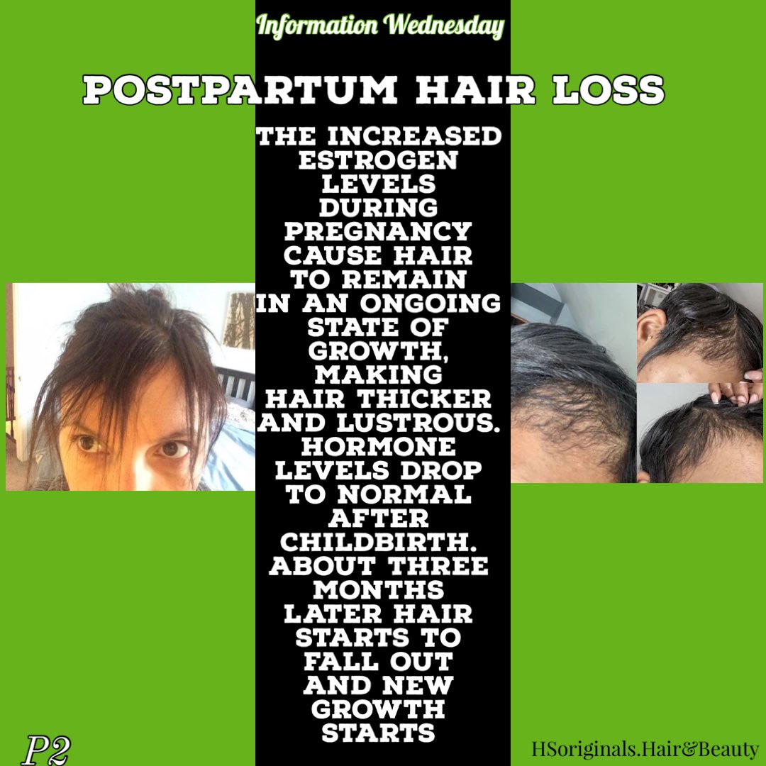 HS_originals1's tweet photo. Information Wednesday, Today we’re addressing the post-partum  hair loss. For instance did you know . . .
#HSoriginals.Hair&amp;Beauty 
#InformationWednesday
#BlackOwnedBusiness
#WigsAndHairExtensions
#HairTutorials
#HairCare
#Hair
#HumanHairWigs
#HairLoss
#Alopecia
#PostPartum
#Bald https://t.co/vf3HlfuxHx