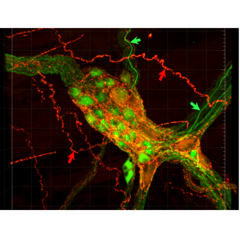 sparc_science's tweet photo. #NIH_SPARC Story @YvetteTache lab's comprehensive #Immunohistochemical labeling #antibodies database -Never before detail of #NeuronalCircuits in #colonic tissue #innervation for #DigestiveDiseases #IBD #Peripheral #neuromodulatory therapies https://t.co/l4EyAL6Nn9 https://t.co/RbraRQuEoj