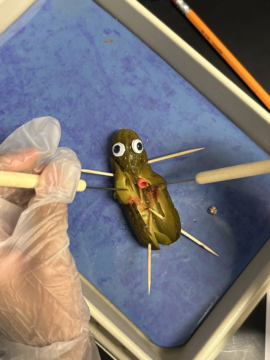 Pickle autopsy 
#Ofamily #oms