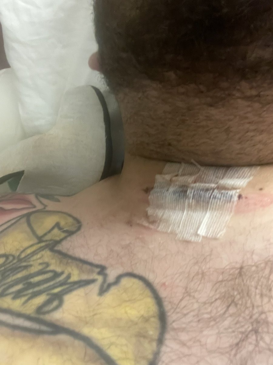 A week after a fusion in my neck and I’m still not feeling right