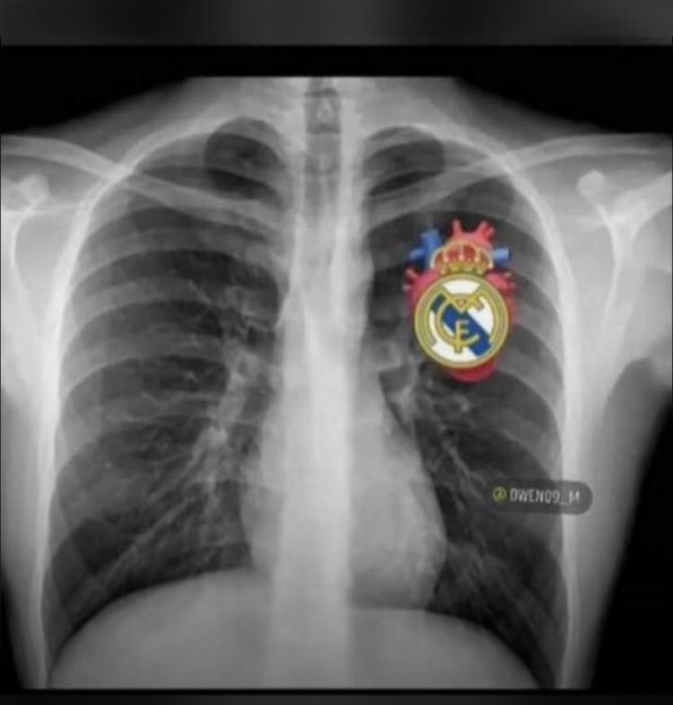 off_lito's tweet photo. Peu importe la défaite Réal Madrid a vie Hala Madrid ❤️🔥 https://t.co/ufNr4ArwDn