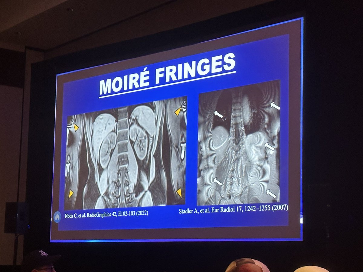 🤩😂🎉 Jeopardy!!!! Or is it Pictionary??? #SPR2023 <a href="/SocPedRad/">The Society for Pediatric Radiology</a> we wait every year for this fun session!!!! 🍹🍾🥂🥃💗 Texas vs the World! 🤠🌎🌍 🧠 #Gamification #FunInLearning   Host: <a href="/reh3md/">Rich Heller</a> and team captains: <a href="/MarlaSammer/">Marla Sammer, MD, MHA, FAAP</a> <a href="/iyer_md/">Ramesh Iyer, MD, MBA</a> ☢️🩻🎊
