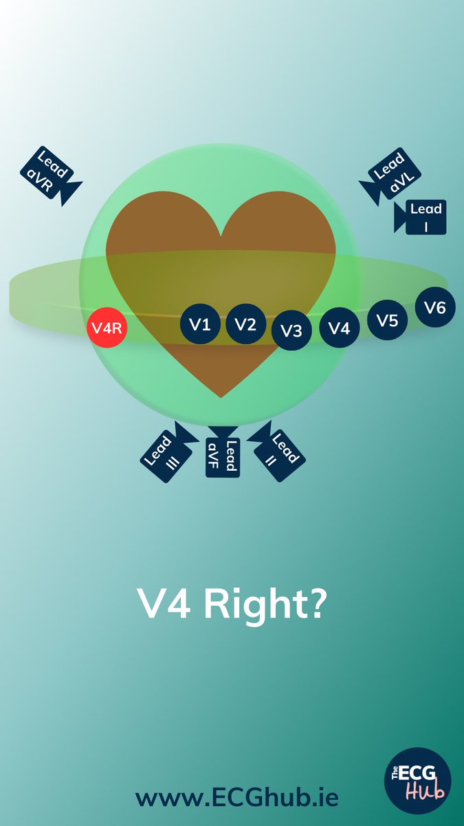 The ECG Hub tweet media