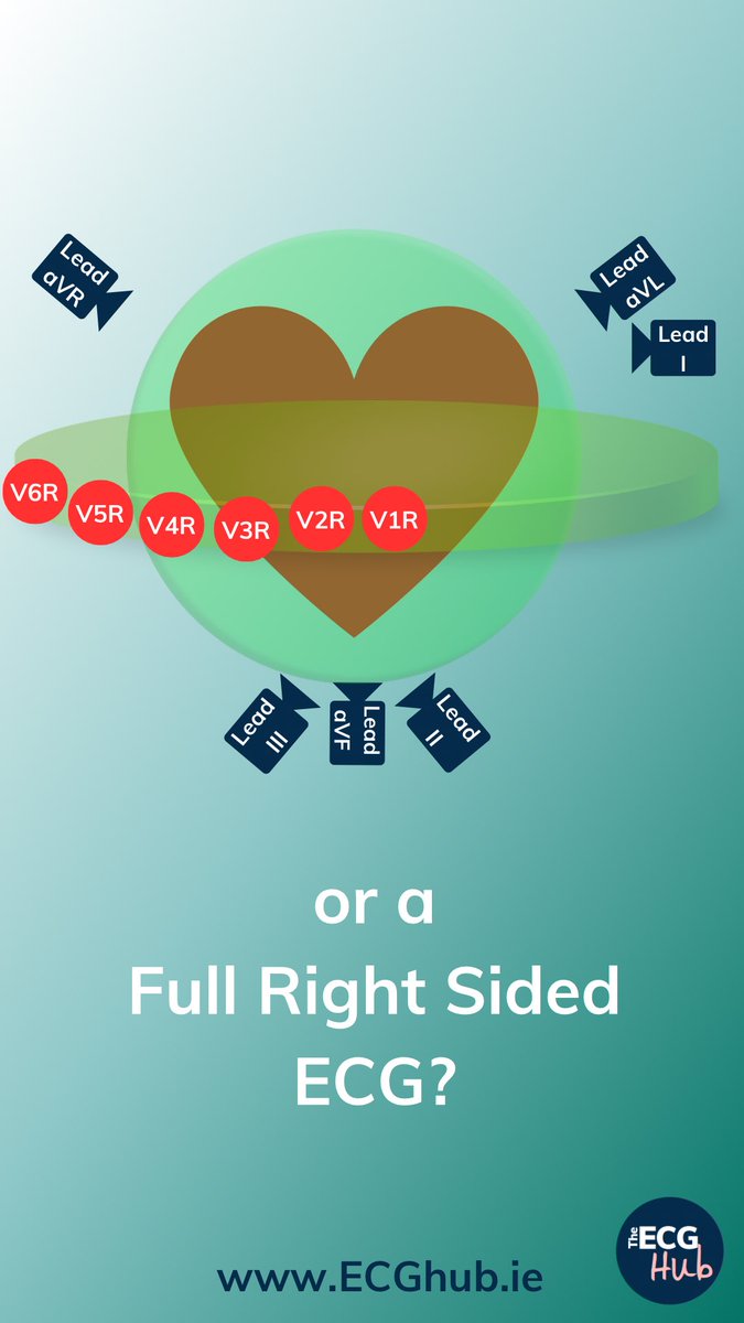 The ECG Hub tweet media