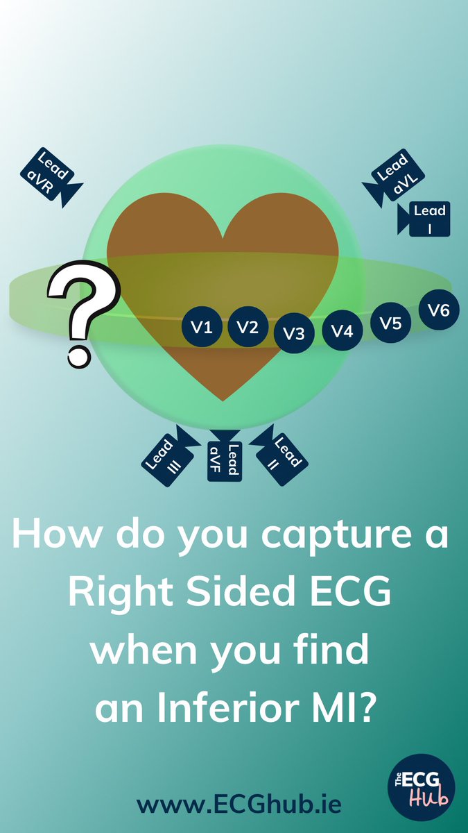 The ECG Hub tweet media