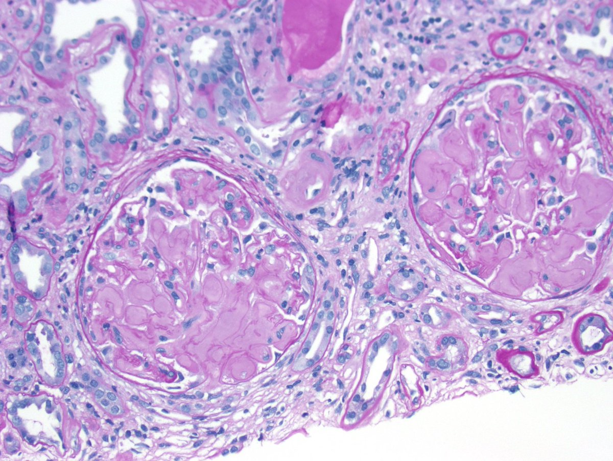 Kuang-Yu Jen, MD, PhD tweet media