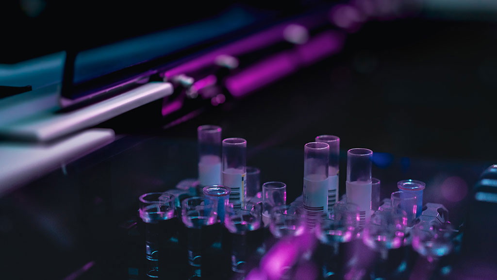 Analizador de inmunoensayo de próxima generación cuenta con el mayor rendimiento de la industria con realación a... labmedica.es/diagnostico-mo…