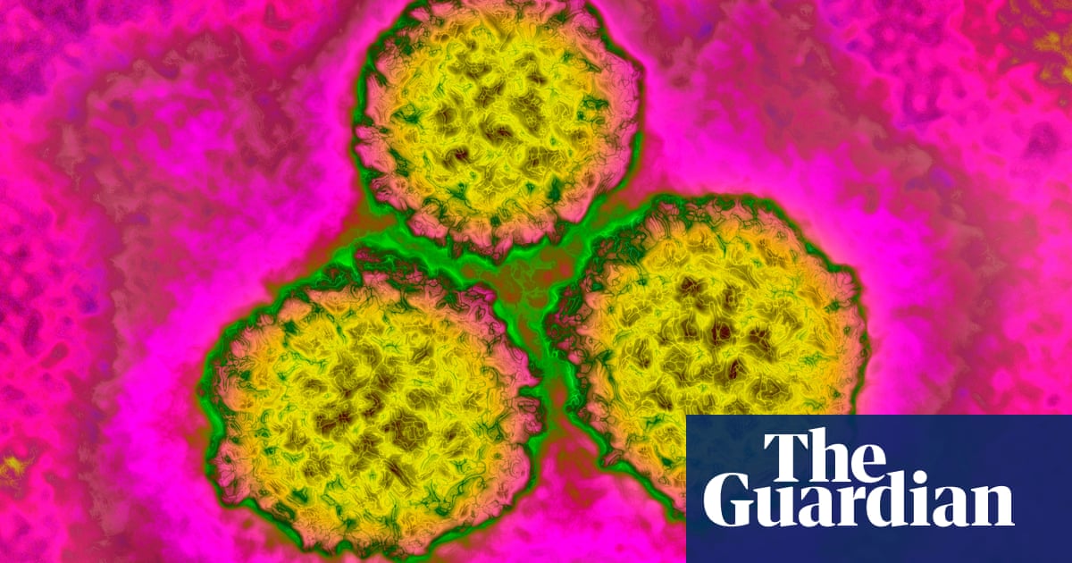 guardiannews's tweet photo. Microwave device could be less invasive treatment for HPV-caused cancers https://t.co/XwBB45cfKr https://t.co/16QrCQxL1h