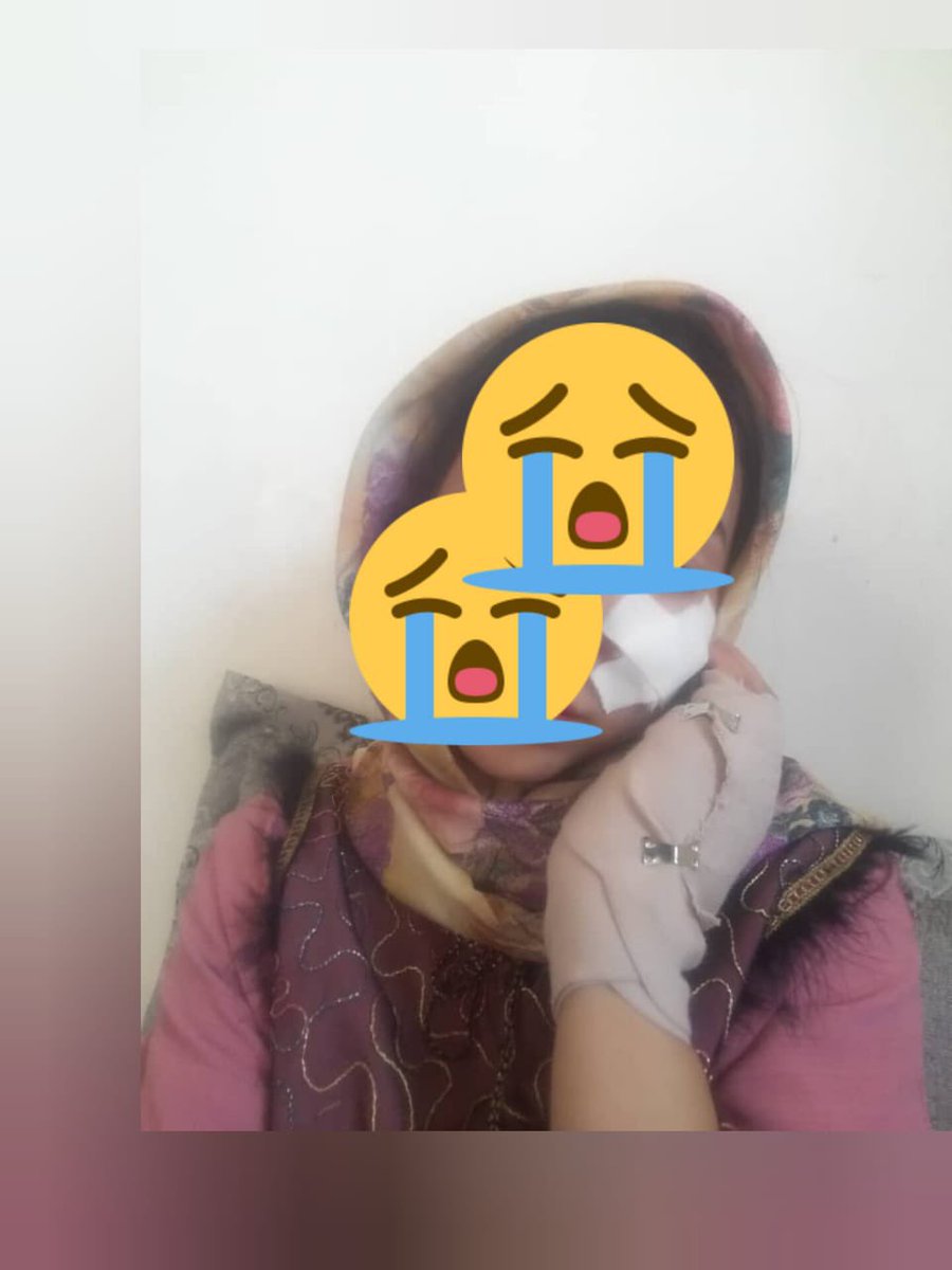 womenaidafghan1's tweet photo. لطیفه حسینی وکیل مدافع در ولایت بامیان بود .
او بنابه مشکلات امنیتی محل زندگی اش را تغیر داده بود ،متاسفانه دیروزدرمزارشریف طالبان به وی حمله ور شده وصورتش را به شکل فجیع با چاقو پاره کرده اند. این افراد طالبان همچنان اورا انداختند پایین که متأسفانه یک دست ویگ‌پایش  شکسته ودرحالت بد صحی ق��ار دارد. بدبختانه هر روز شاهد ازبین بردن زنان فعال به شکل های مختلف میباشیم.
#BanTaliban
#همیار_زنان_افغانستان