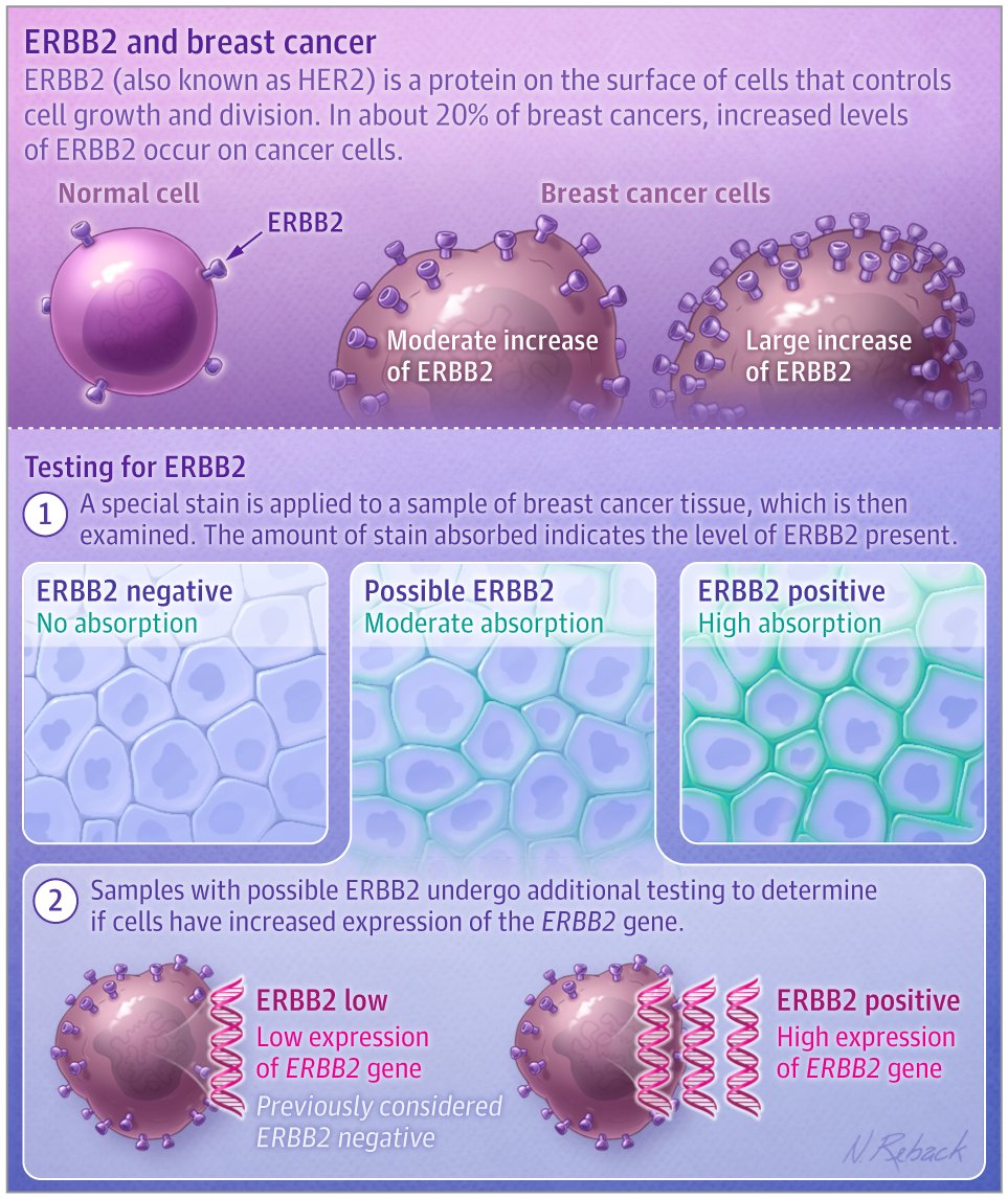 Patient page describes ERBB-2 low/HER2 low #breastcancer, including how it is defined, what it means, & new treatment options for a significant subgroup of patients. ja.ma/3NS3STh #BCSM