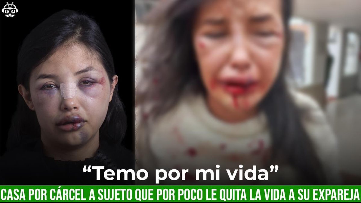 mimitasolano's tweet image. #JusticiaParaPilar #NiUnaMas 
Alerta en Fusagasugá, casa por cárcel para agresor.
fb.watch/kBfX7-HR8S/?mi…