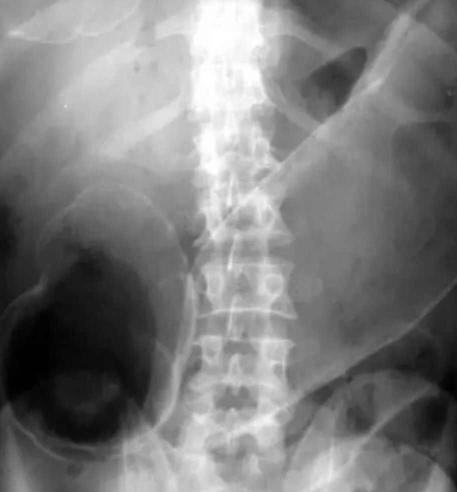 radRounds Radiology Network tweet media