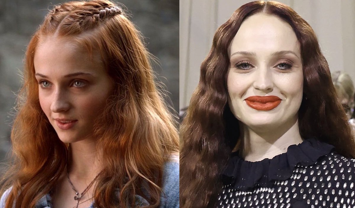 bizlet7's tweet image. British genes activated.