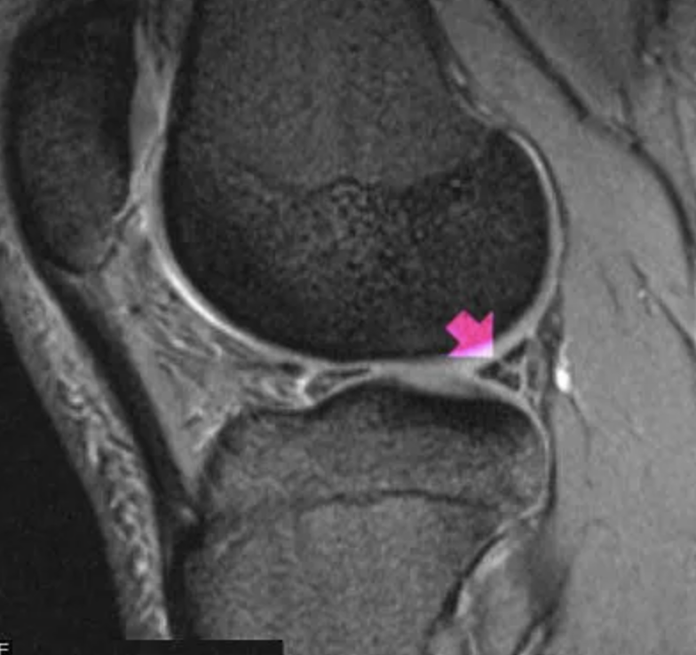 radRounds Radiology Network tweet media