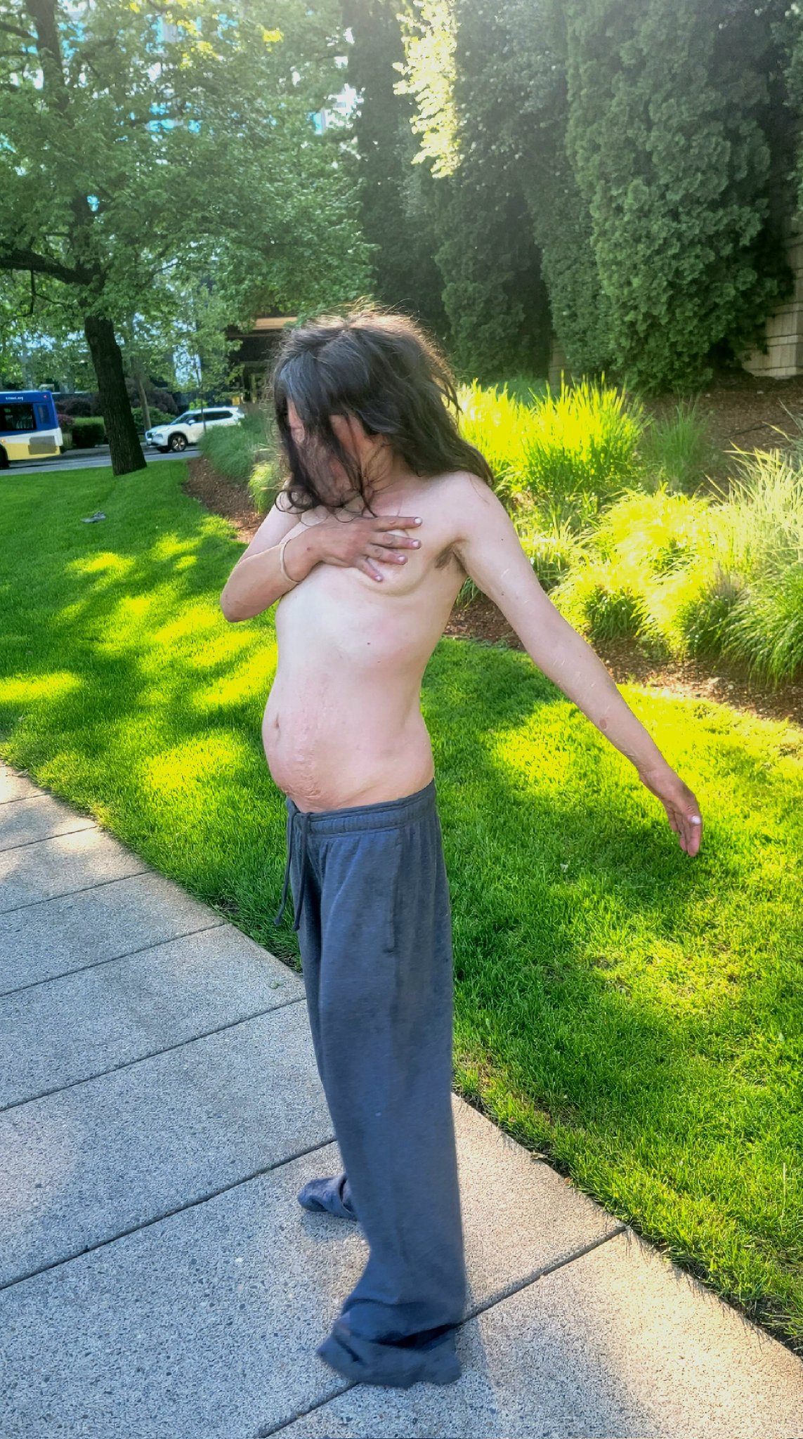 meth nude I was in Portland and came across a naked #homeless woman having a drug-induced #MentalHealth crisis. Jasmine believed she was covered in bugs. She told