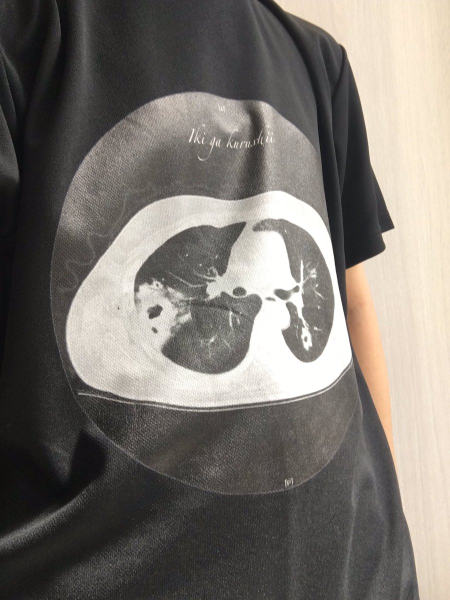 nagasakiinu's tweet photo. この間から肺炎で肺にクソデカ空洞が出来たので記念にTシャツにして検診に着て行ったら医者に笑いながら笑い事じゃねぇーって叱られた
そりゃそうだ

診察の後「こっちの画像にしなさい」て綺麗な頃の肺の画像もらった
ピース https://t.co/aQj7iKo0Ki