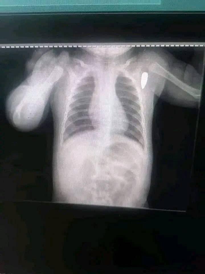Nmhali's tweet photo. A baby was injured by a stray bullet 💔
#SudanCrisis 
#KeepEyesOnSudan https://t.co/gMuicsSAav