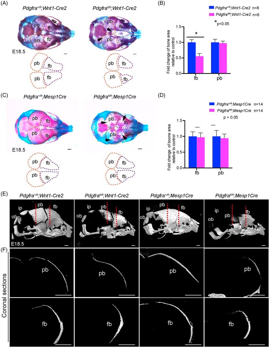 DevelopmentalDy's tweet photo. Mammalian calvarial #bones are derived from #neuralcrest cells or #mesoderm. Learn how these #progenitor cells respond differently to #PDGFR signaling which is important for cell #proliferation, #migration and #osteoblast #differentiation. https://t.co/3jJo41lpKP https://t.co/clmWzib0mk