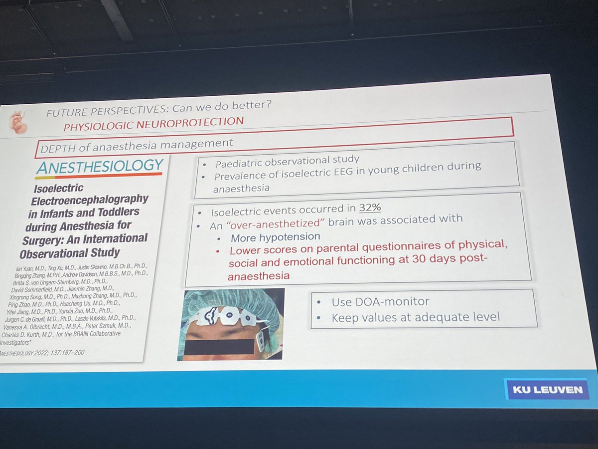 Nuala Lucas (@noolslucas) on Twitter photo <a href="/DevroeSarah/">sarah devroe</a> highlights the role of #depthofanaesthesia monitoring in #obsanaes - balanced anaesthesia (awareness vs over-anaesthetising)
#OAA23ASM
pubmed.ncbi.nlm.nih.gov/35503999/ <a href="/DevroeSarah/">sarah devroe</a> highlights the role of #depthofanaesthesia monitoring in #obsanaes - balanced anaesthesia (awareness vs over-anaesthetising)
#OAA23ASM
pubmed.ncbi.nlm.nih.gov/35503999/