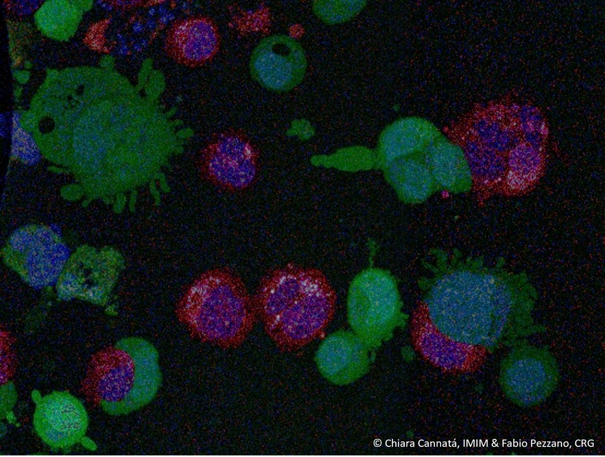 emblebi's tweet photo. When they metastasise, cancer cells overcome  challenges, similar to a decathlon at cellular scale.

The @Plast_Cell initiative quantifies a cancer cell’s ability to respond to such environmental stress, to understand tumour progression and aggressiveness.
https://t.co/nTWcrKmqPK https://t.co/dKhQev81UI