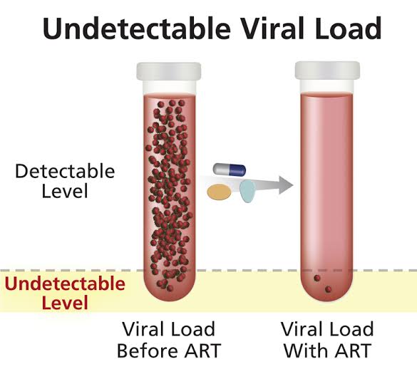 Ugo_PNnamdi's tweet photo. What is your recent viral load result?

You should know. Your healthcare provider gives and explains your result to you. It's your right.

To suppress it with #ARV is what we are aiming at. #UequalsU puts you or your sexual partner(s) at NO RISK.

#HIV treatment works. https://t.co/DiVzol7Z0C