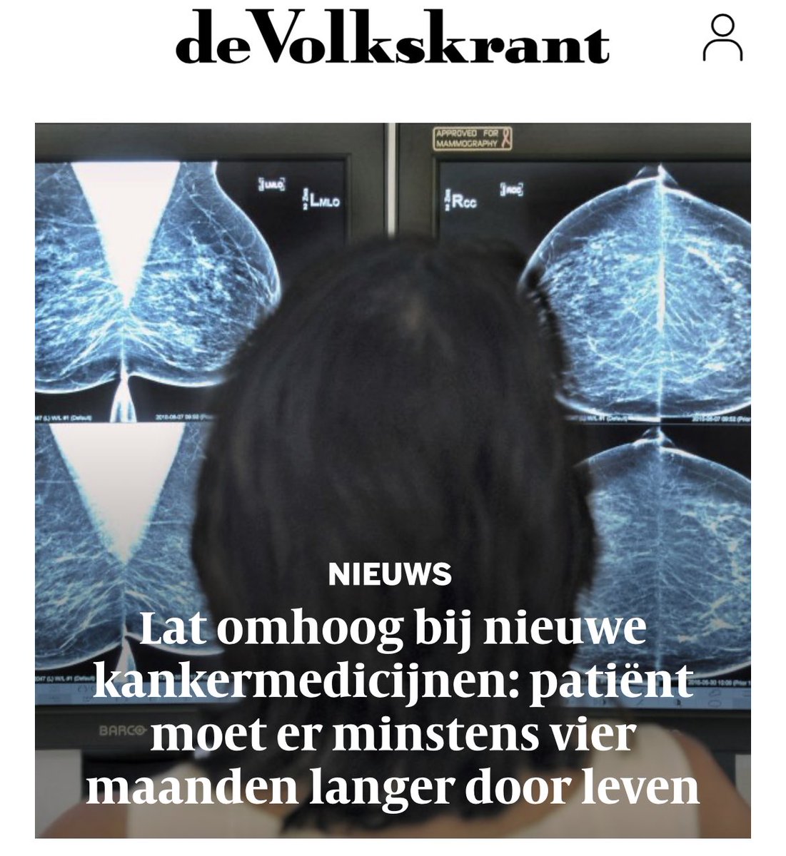 Interessante kop.