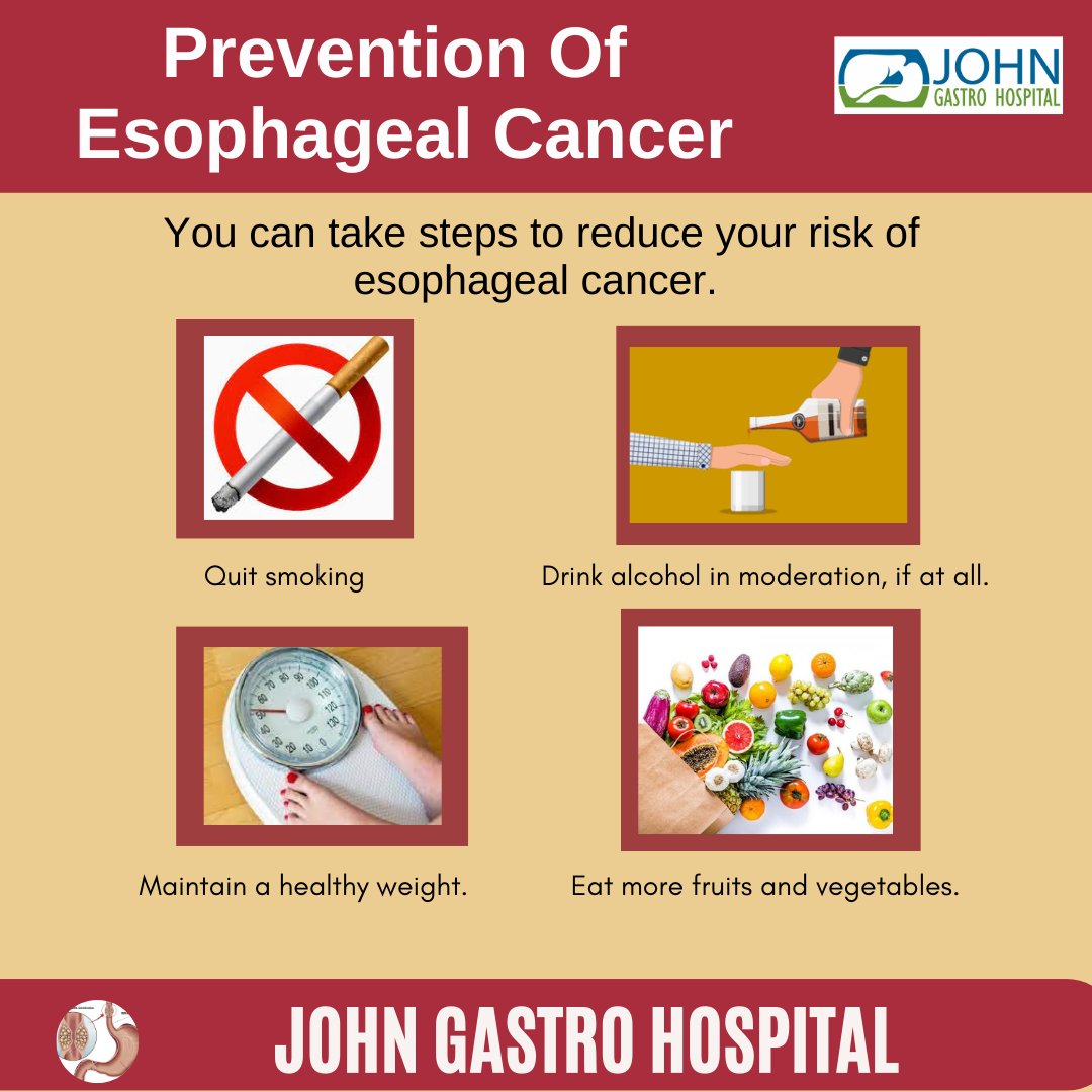 John Gastro Hospital, its the best hospital in town, doctors here provide the correct  diagnosis and accordingly the best treatment #Nagercoil #kanyakumari #esophagealcancer #cancer #endoscopy #stomachache #stomachcancer