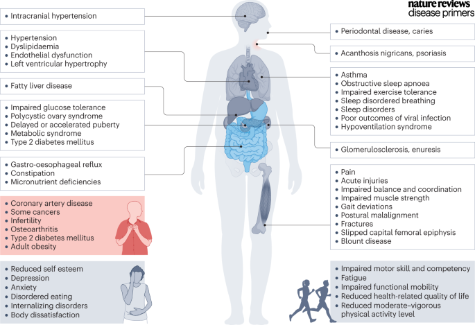 #Obesity in children and adolescents can be accompanied by various other pathologies go.nature.com/3BCTIi7