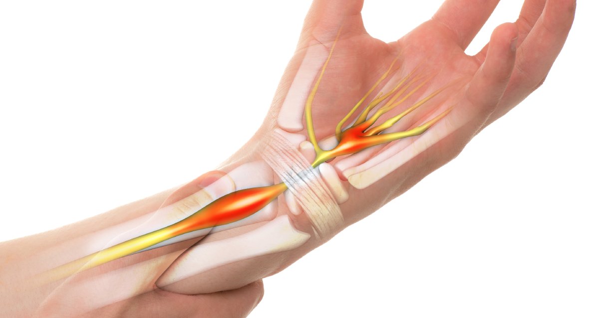 Want to reduce your risk for carpal tunnel syndrome? Start by paying attention to how much pressure you put on your hands -- here's how: wb.md/42nne76