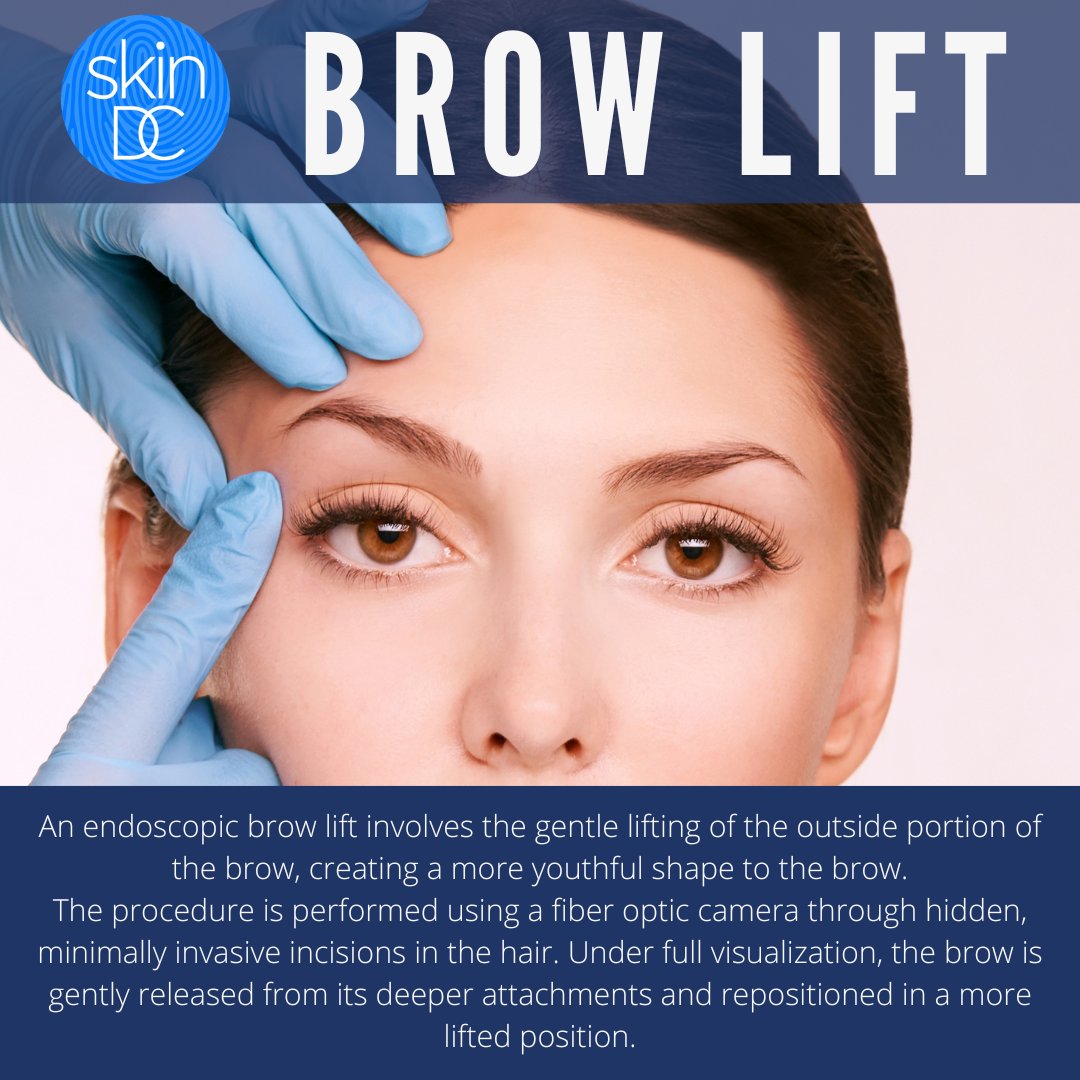 SkinDCDerm's tweet photo. Elevate your look with a brow lift ✨

Designed to enhance the shape, position, and overall appearance of your brows and eyes, giving you a refreshed and rejuvenated look 🤩

Schedule a surgical consultation with Dr. Cabin today! 
•
•
•⠀
#browlift #dmvplasticsu... https://t.co/EikW82fhyW