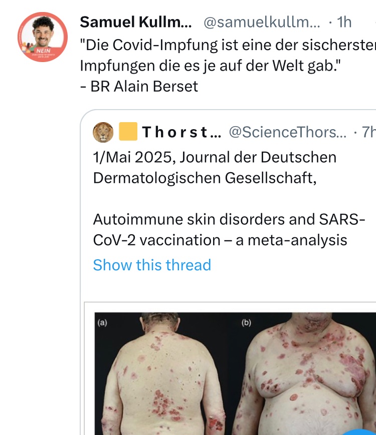 ChantalStadelm1's tweet photo. Wer gerne #Laborratte spielt selber schuld! 🐀
Grösstes Med. #Impfverbrechen des 21. Jahrhunderts!
#Impflüge
#Impfbetrug
#Nürenbergerkodex
@hardmanpolitics
Nein zum COVID-Gesetz am 18. Juni 2023 unsere Grunderechte sind nicht verhandelbar! Schluss Punkt und Amen! 🇨🇭🕊 https://t.co/0aAm8GKSfz