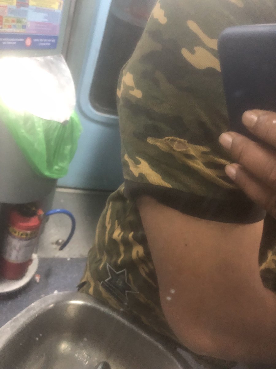 Shukla_ash's tweet photo. ⁦@IRCTCofficial⁩ ⁦@RailMinIndia⁩ Today I am  traveling from Nizamuddin to Nashik in Rajdhani express no 22222 seat no A1/17 and met with an accident while going out to use Toilet , My arm completely got scratched and my T shirt worn out , I have shared the piks also https://t.co/lnuc4y2wwB