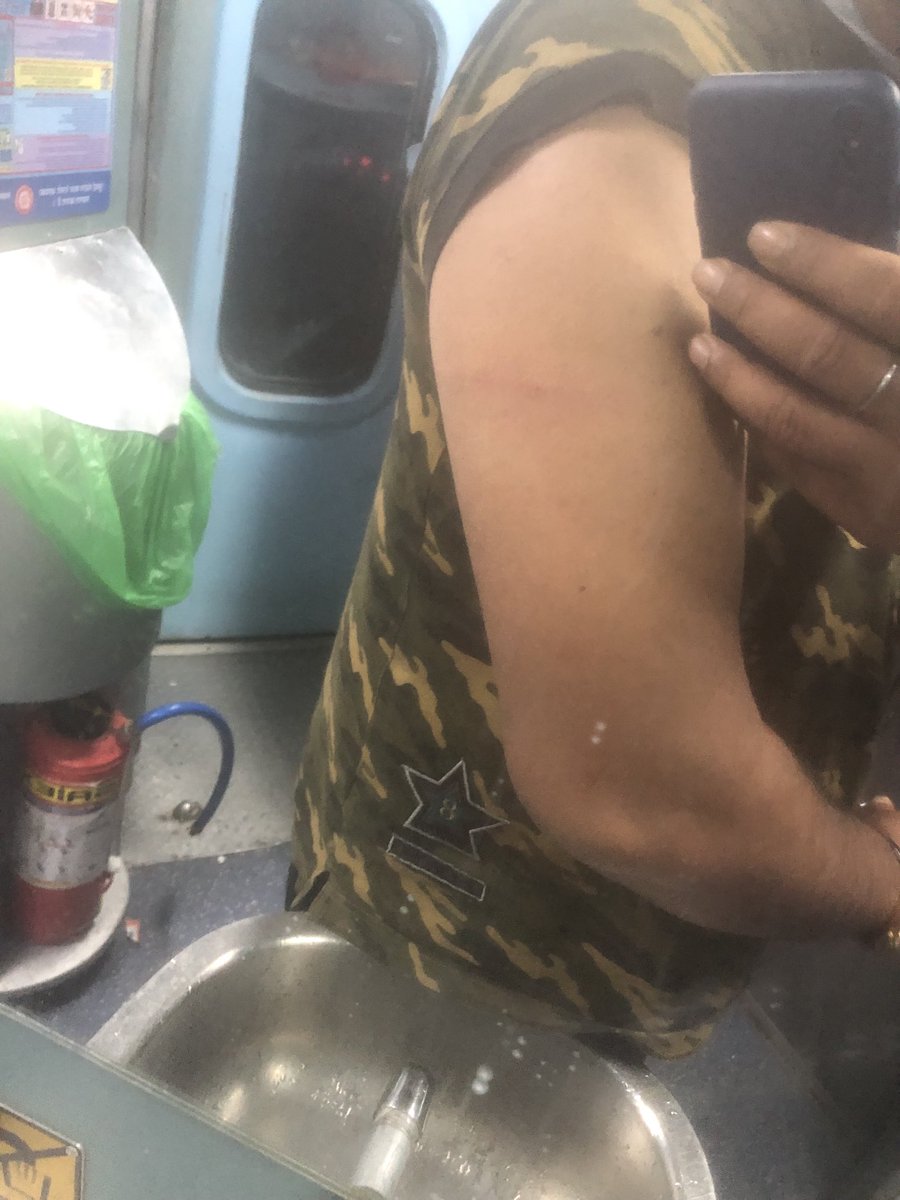 Shukla_ash's tweet photo. ⁦@IRCTCofficial⁩ ⁦@RailMinIndia⁩ Today I am  traveling from Nizamuddin to Nashik in Rajdhani express no 22222 seat no A1/17 and met with an accident while going out to use Toilet , My arm completely got scratched and my T shirt worn out , I have shared the piks also https://t.co/lnuc4y2wwB