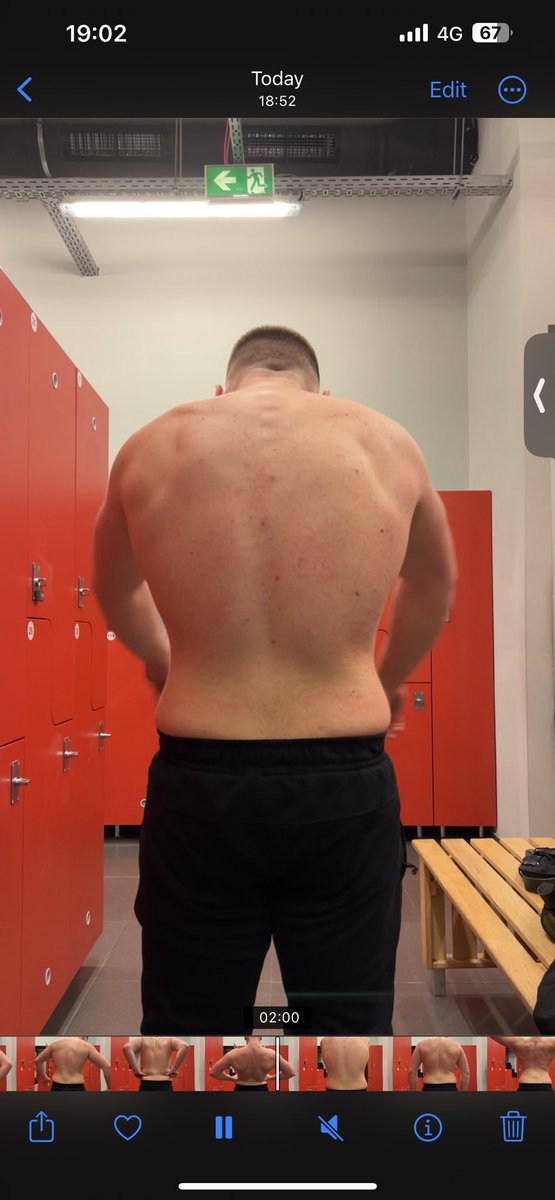 Can you find the difference between the next 2 stories