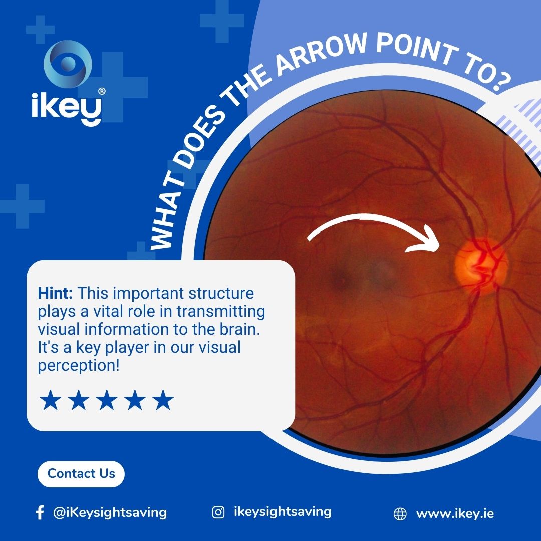 Can You Guess What the Arrow Points to?
Share your thoughts in the comments, and stay tuned for the reveal in the next post. Who's up for the challenge? Let's find out!

#ikeysightsaving #SightSaving #VisionCare #EyeHealth #VisualPerception #CanYouGuess #EyeMystery