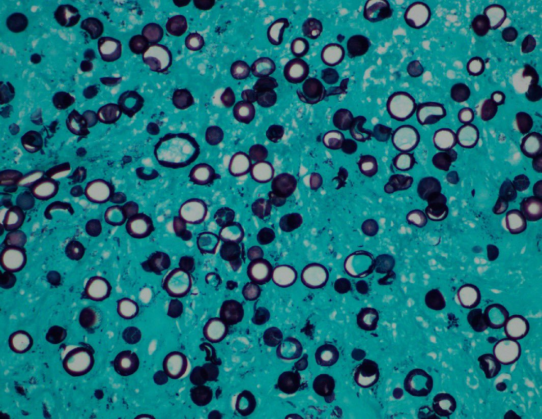 A Matloob, MD tweet media