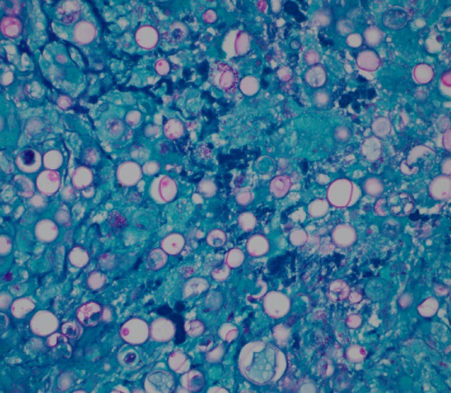 A Matloob, MD tweet media