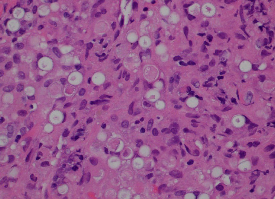 A Matloob, MD tweet media