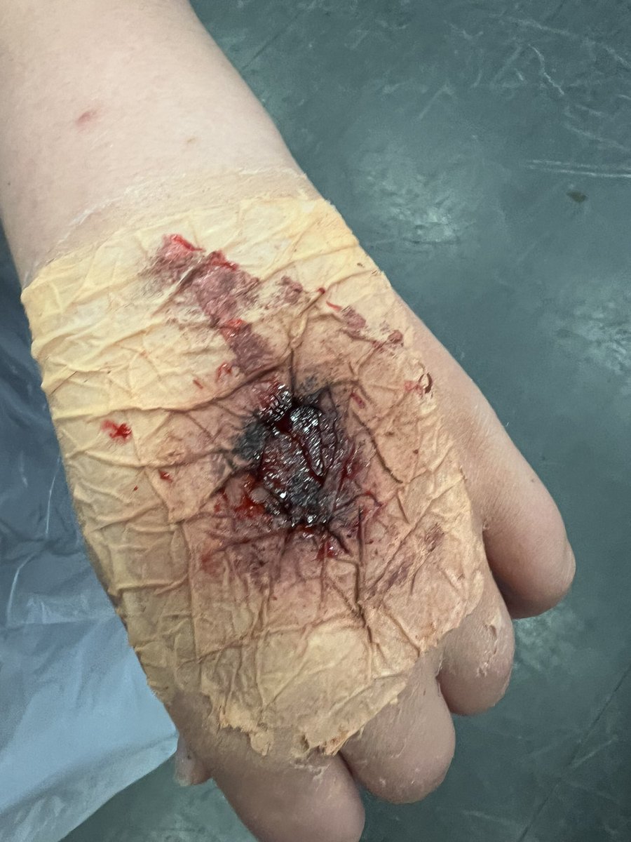 Lots of disgusting cuts in our SFX Makeup Enrichment this week! 🤮🫣⚠️ Made with just PVA glue, tissue, eyeshadow and concealer! 🎨🪄
@willowshigh #WillowsEnrichment #enterprisingcreativecontributors