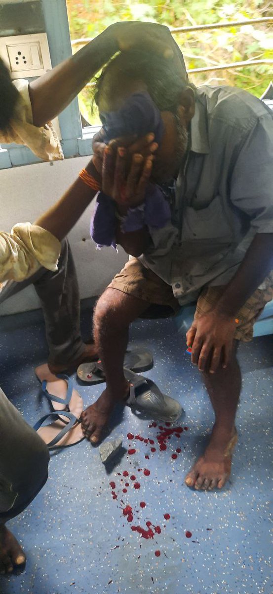 Balaji42471468's tweet photo. Today 16211 YPR-SA again stone pelting in same spot where it happened a month back. Is passengers safety totally forgotten by SWR?? @drmsbc @RailMinIndia @SWRRLY @narendramodi @AshwiniVaishnaw sever eye injury to passenger. @rpfswrsbc https://t.co/vZSugAPBbp