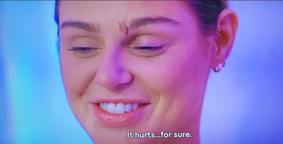 imonabeachbeech's tweet photo. That will heal, the emotional damage you and #Scumdoval have done will last far longer than some little scratch.  You think THAT is your karma?  🤣🙄 https://t.co/pyVJwBPKl8