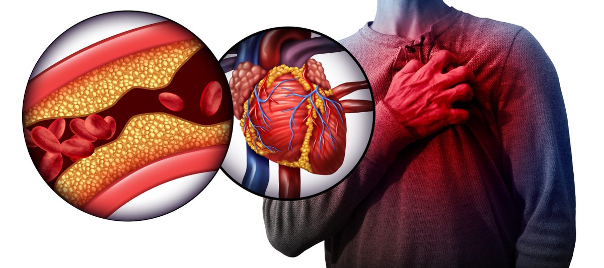 Facts about Cholesterol and Heart Disease
