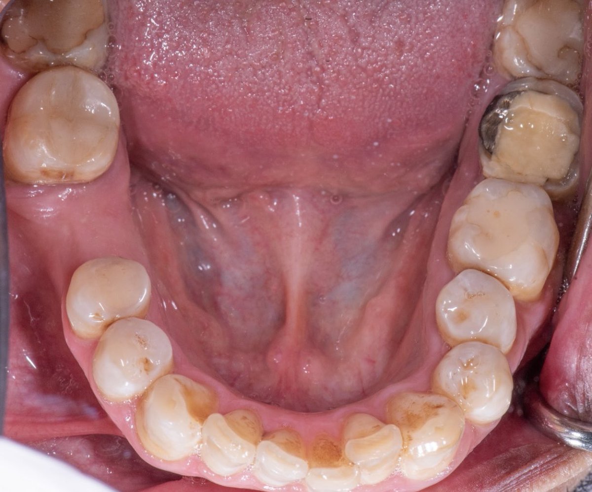 Abdulelah Alqahtani | د.عبدالاله القحطاني tweet media